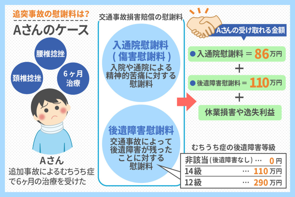 追突事故の慰謝料ケース